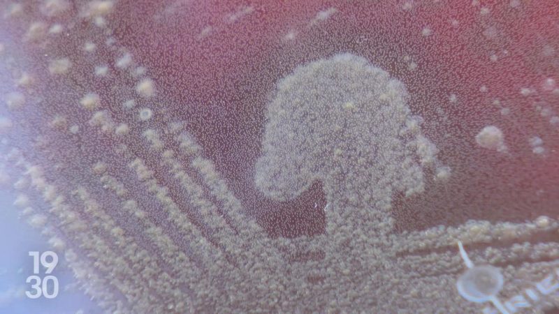 Sepsis en Suisse : un enjeu de santé publique encore sous-estimé