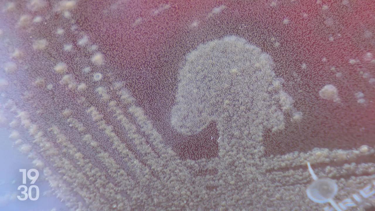 Sepsis en Suisse : un enjeu de santé publique encore sous-estimé